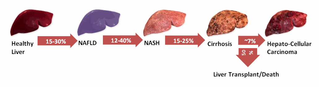 Covance-Noninvasive-Biomarkers-in-NASH-Blog (1).gif
